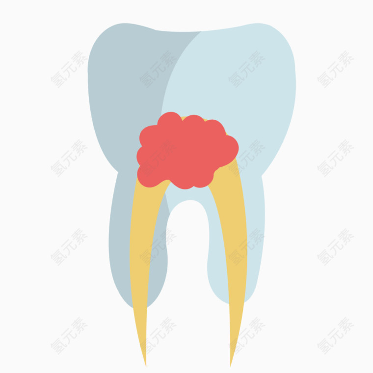 矢量扁平化蛀牙