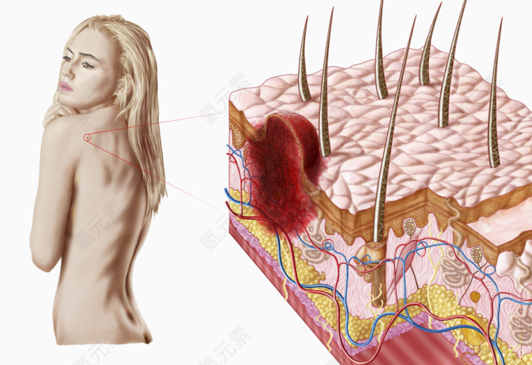 皮肤发炎图片