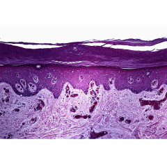 紫色皮层组织