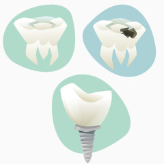 矢量牙齿根部