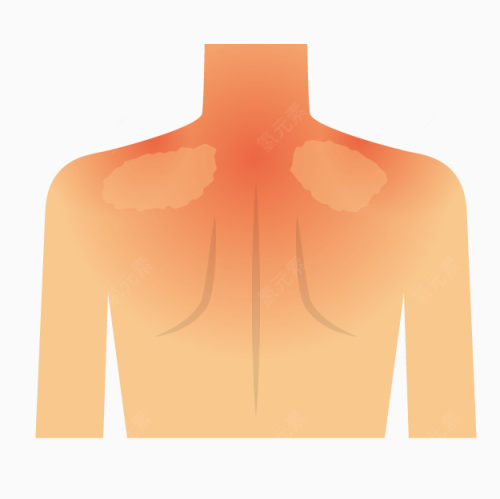 卡通颈椎肩周病下载