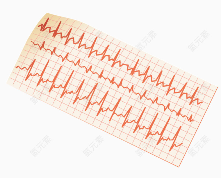 矢量心电图记录纸