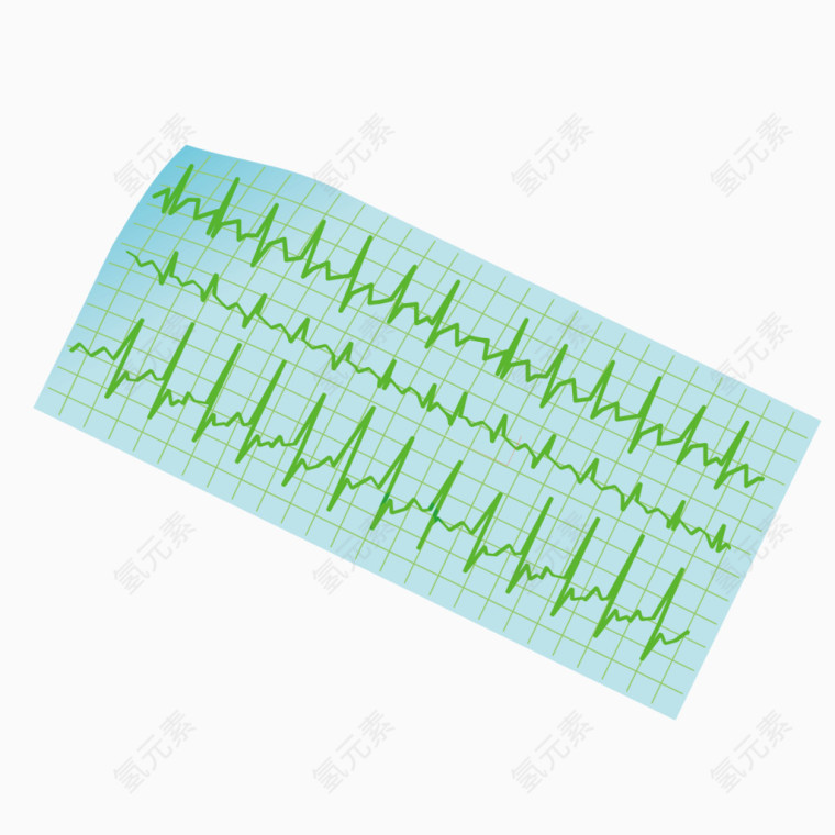 绿色质感心电图报告