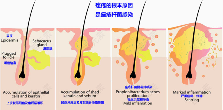 毛囊细胞生长图