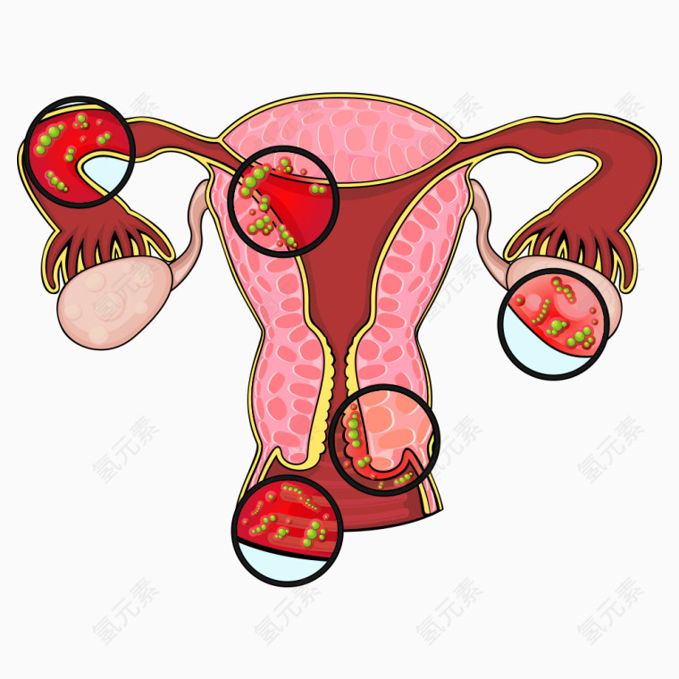 矢量妇科病毒