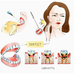 牙医手术医疗插图
