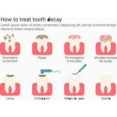 如何治疗龋齿信息图表矢量素材