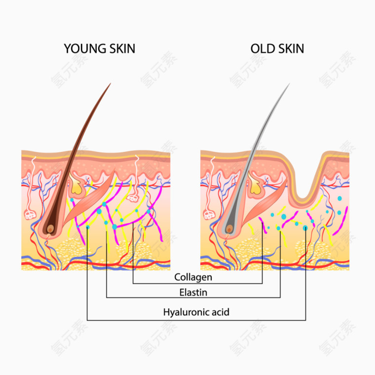 矢量毛囊健康对比图