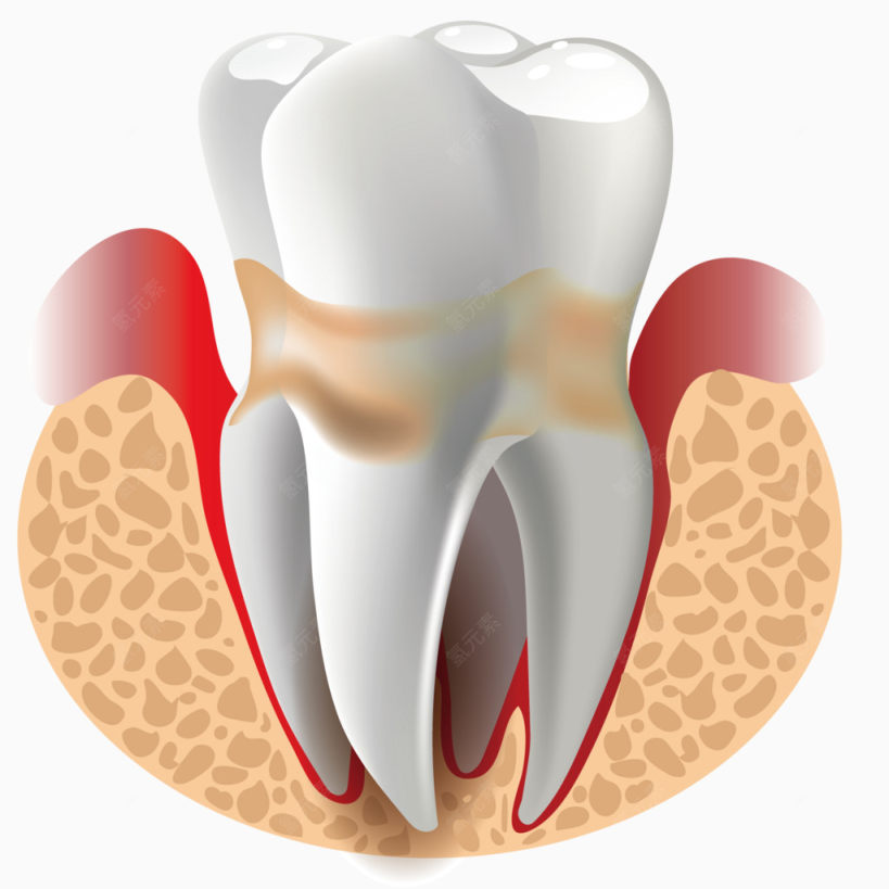 矢量医疗齿根下载