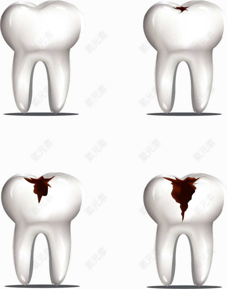 矢量手绘蛀牙