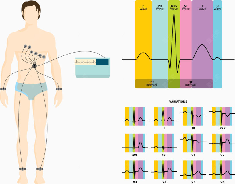 矢量图心电图下载