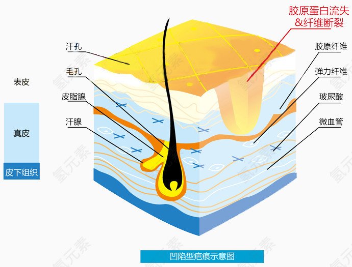 生活常识皮肤结构