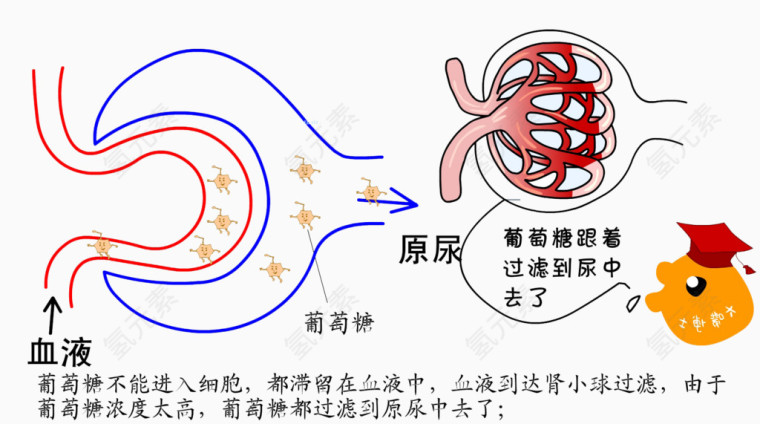 糖尿病原理