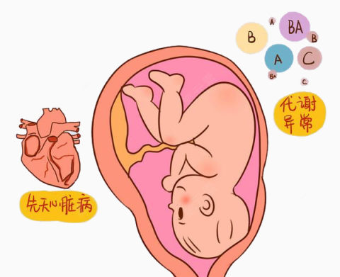 胎儿先天心脏病预测下载