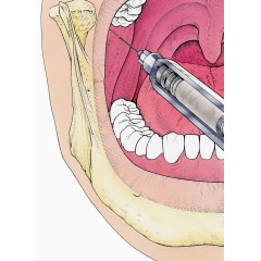 口腔卫生医疗插图