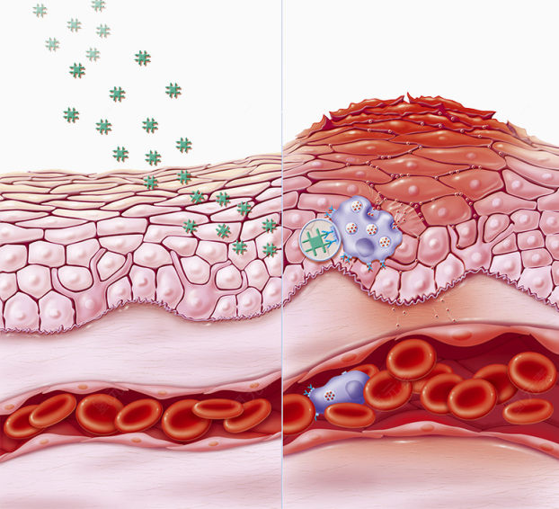 炎症皮肤图片下载
