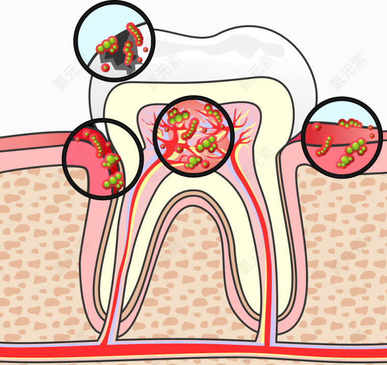 矢量病菌牙齿