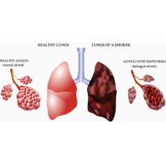 健康肺和香烟污染的肺对比图