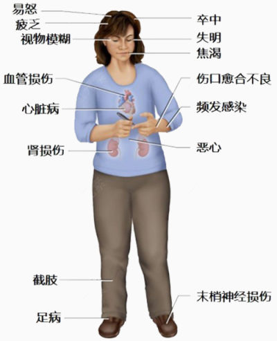 糖尿病患者症状下载