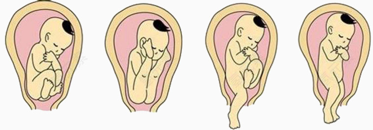 胎儿的出生