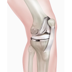 膝盖骨头结构