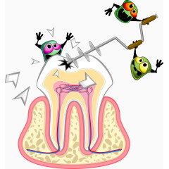 破坏牙齿的矢量细菌