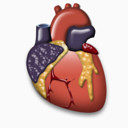 心脏病学心器官X-Mac
